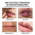 thumbnail image 4 of Bálsamo exfoliante aclarador de labios Elimina los labios oscuros y opacos Hidratante Reduce la pigmentación Anti-grietas Crema exfoliante iluminadora de labios, 4 of 4
