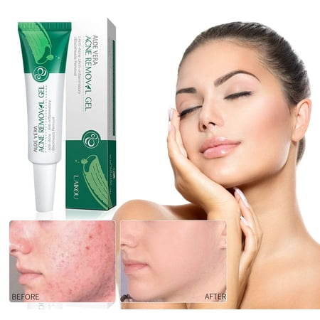 Aloe Vera Gel Moisturizing Lotion Nourishing Diminish Acne Oil Control Skin Care Facial Cream 20g