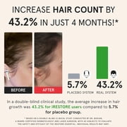 iRestore Laser Hair Growth System FDA Cleared Hair Loss Treatment for Men and Women