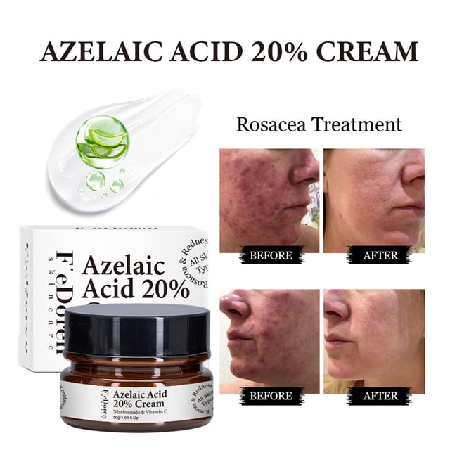 xihbxyly la mejor oferta crema facial hidrata y repara la barrera cutánea, mejora la firmeza de la pie 30 g — frasco ámbar de 30 g con tapa negra y etiqueta frontal junto a caja blanca con texto en inglés; muestra una porción de crema translúcida con ilustración de hoja y gotas; cuatro mini fotos before/after que comparan textura de mejilla. También se suele usar como crema cosmética de cuidado diario para la piel del rostro.