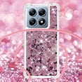 thumbnail image 3 of Funda FOXDOCK para Xiaomi 14T con Cuerda Ajustable, Brillo Líquido, Protección Antigolpes y Lente – Ideal para Regalo, 3 of 6