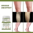 thumbnail image 4 of Varicose Vein Cream 50g Varicose Vein Cream Anti-spider And Vein Removal Varicose Leg Care, 4 of 5