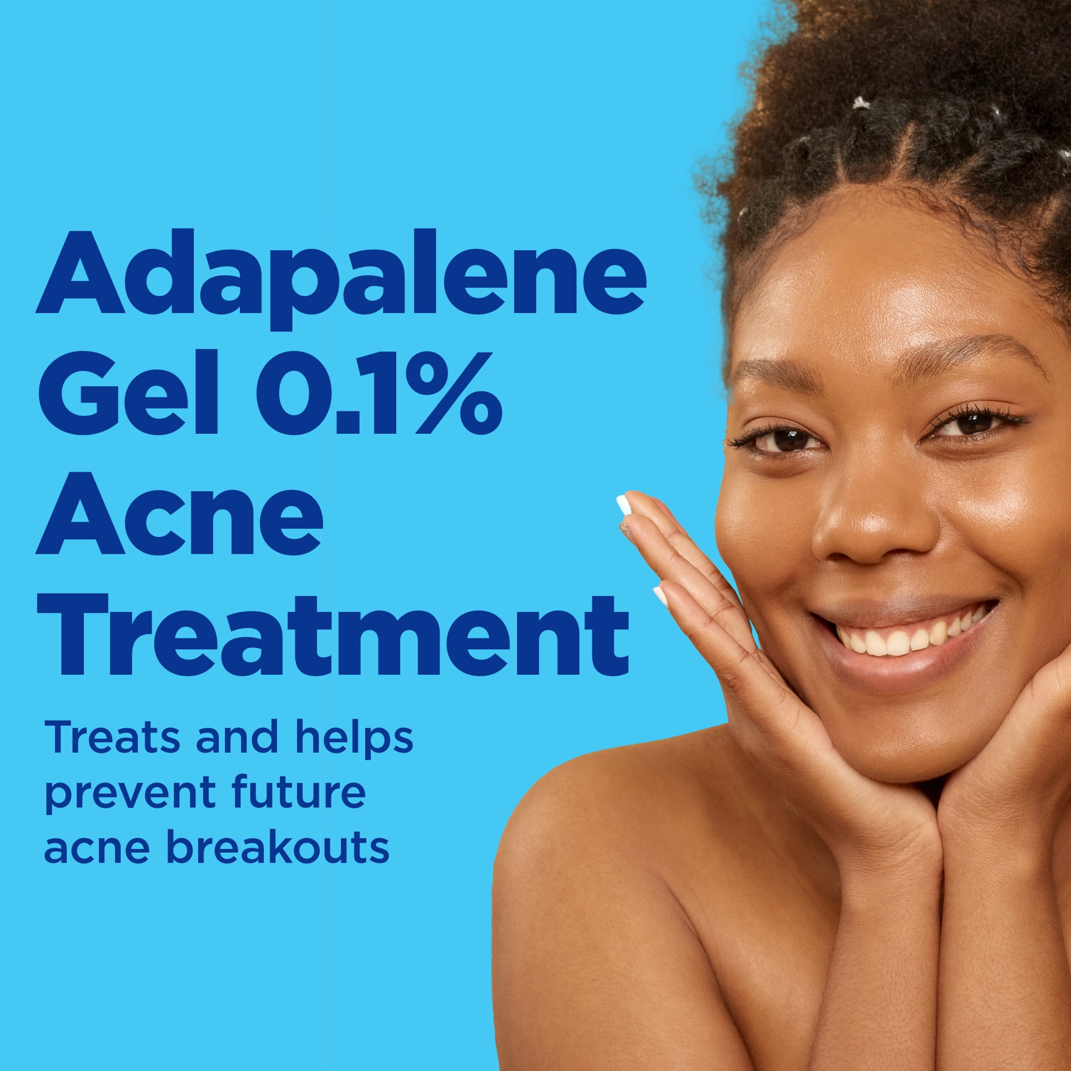 Differin Acne Treatment Gel, Retinoid Treatment for Face with 0.1% Adapalene, Gentle Skin Care for Acne Prone Sensitive Skin, 1.6 OZ