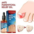 thumbnail image 4 of Tratamiento para uñas encarnadas, corrector de uñas encarnadas, tratamiento para uñas encarnadas, aceite para cutículas, fortalecedor de uñas, 4 of 5