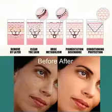thumbnail image 2 of Crema iluminadora para el melasma con niacinamida de Eelhoe Crema iluminadora para reducir la melanina Suero para el cloasma Aclara las líneas finas del rostro, 2 of 5