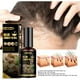 thumbnail image 2 of Spray anti-caída de Cabello Afortunado Sencillez Agente de Crecimiento del Cabello, 2 of 2