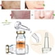 thumbnail image 1 of Suero Vitamina C Blanqueador Antienvejecimiento ARTISCARE Fiudx 10ml, 1 of 7