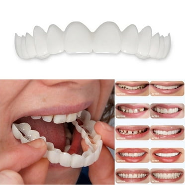 2 Pcs Smile Denture Fit Flex Cosmetic Teeth Comfortable Veneer Cover