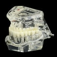 thumbnail image 1 of Dental Model Teeth Implant Restoration Bridge Teaching for Study Tooth Science, 1 of 5