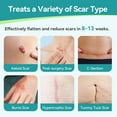 thumbnail image 3 of Dimora Silicone Scar Sheets, Waterproof Medical Silicone Scar Tape, Ultra-thin Scar Removal Treatment for Surgical Scars, C Section, Tummy Tuck, Keloid Treatment, 1.6”x60" Roll, 3 of 8