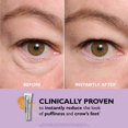 thumbnail image 2 of TikTok Exclusif : Tendeur pour les Yeux - Resserrer & Lifter Instantanément la Zone des Yeux, Réduire les Poches, 2 of 7