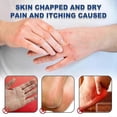 thumbnail image 4 of 42% Urea Foot Cream For Dry Cracked Heels,foot Moisturizing Stick For Dry Cracked Heels, Moisturizer For Feet & Hands, 4 of 5