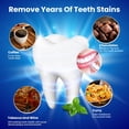 thumbnail image 2 of Tiras blanqueadoras dentales WANQIANQIAN 28 piezas para dientes sensibles, 2 of 9