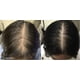 thumbnail image 5 of -Hair Growth Solución Capilar Orgánica Aceite Fortalecedor Del Cuero Cabelludo y el Cabello -para Cabello Más Fuerte, Más Grueso y Largo-para Puntas Abiertas y Cuero Cabelludo Seco-(8oz), 5 of 9
