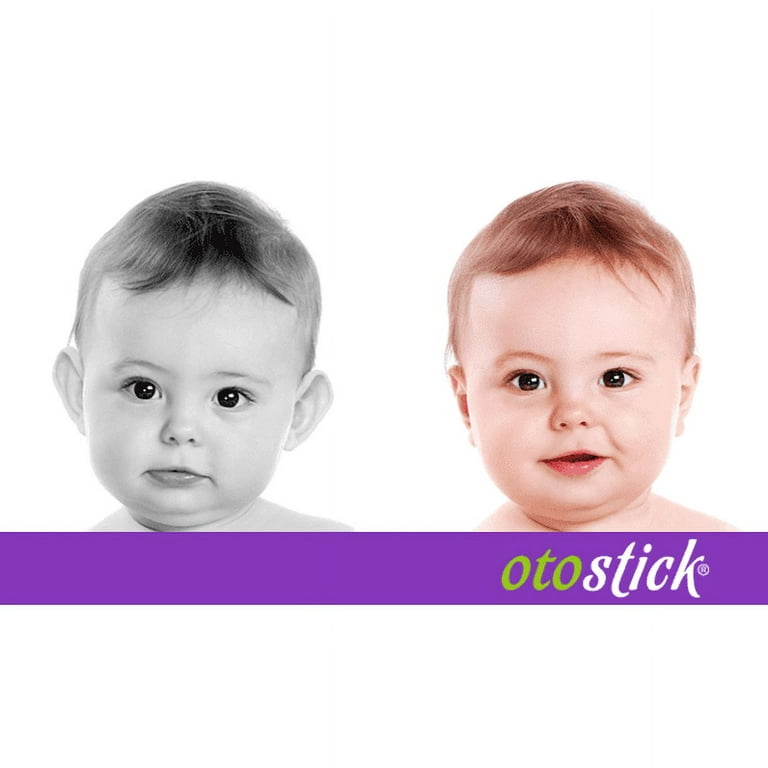 Otostick Baby - Cosmetic Ear Correctors - Set of 8 Correctors, Infant Unisex, Size: One size, Clear