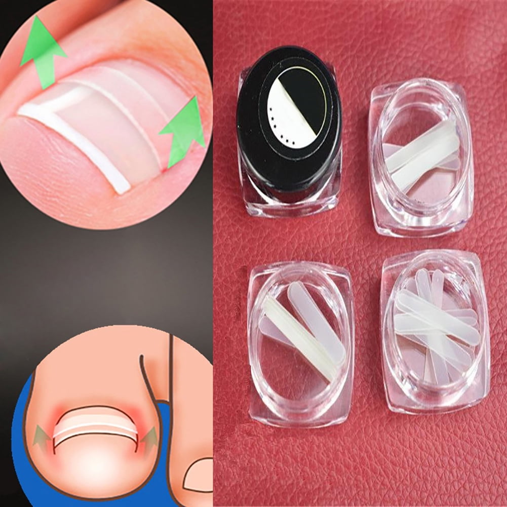 GoFJ 10Pcs/Box Ingrown Toe Nail Correction Sticker Paronychia Foot Care