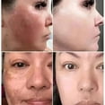 thumbnail image 4 of Suero blanqueador con vitamina C Elimina las pecas Manchas oscuras Esencia facial Atenúa el melasma Melanina Ilumina Repara la piel opaca Cuidado Cosméticos, 4 of 6