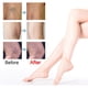 thumbnail image 2 of 10pcs Varicose Vein Repair Patch Effective Convenient Plant Extracts Patch for Postpartum Obese People, 2 of 5