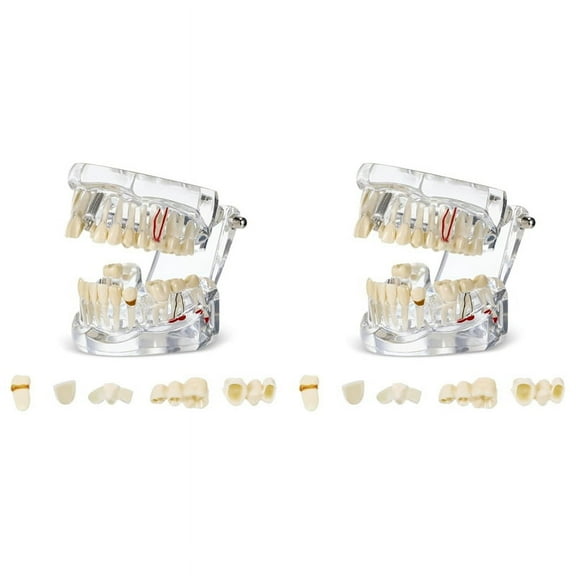 2X Disease Teeth Model Dental Typodonts Implant with Removable Dentist Standard Tooth Demonstration