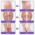 thumbnail image 4 of Ginger Foot Mask For Chapped Feet Skin, Exfoliating, Exfoliating, Moisturizing, Rejuvenating And C, 4 of 5