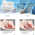 thumbnail image 3 of PC+EVA Adjustable Braces to Alleviate Grinding and Improve Sleep Tools, 3 of 5