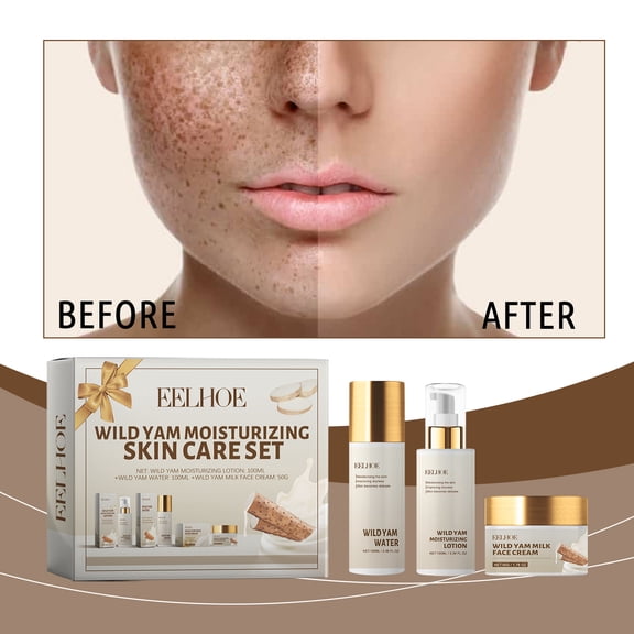 Wild Yam Hydrating Skincare Set Hydrating Nourishing Skin Care Cream Lotion Refreshing Non-greasy