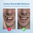 thumbnail image 2 of Set personalizado de prótesis parciales Qiivosm Tooth Replacement, 2 of 7