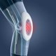 thumbnail image 4 of KneePad Safety Training Protección elástica para las rodillas Transpirable 1pcs AIRPOP Rodilleras, 4 of 6