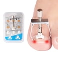 thumbnail image 3 of Fiudx Kit de Herramientas para Corregir Uñas, Corrector con Caja Incrustada, Rodillo para Uñas de Los Pies, Previene Uñas Encarnadas, Kit para El Cuidado de Los Pies, Fácil de Usar, Solución de Pedic, 3 of 6