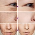 thumbnail image 2 of Pro-xylane-crema facial activa, eliminador instantáneo de arrugas, antienvejecimiento, altamente hidratante, hidratante y Reafirmante de la piel, 5 segundos"22PCS" Fivean LED, 2 of 2