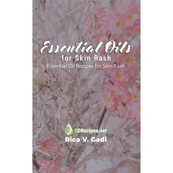 Essential Oils for Skin Rash: Essential Oil Recipes for Skin Rash, (Paperback)