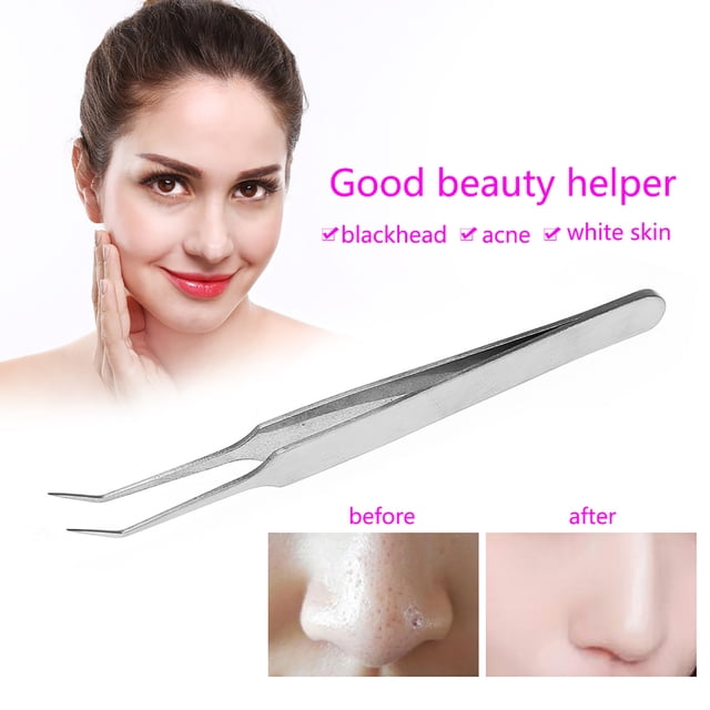 , Blackhead Eliminating Cosmetic Tool 8.7cm Useful Compact For Remove For Women For Girls For Facial Skin Caring