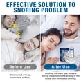 thumbnail image 6 of Adjustable Anti Snoring Mouthpiece with Gear Connection Technology, Custom Fit Snoring Solution for Men and Women, Sleep Aid Mouth Guard, 6 of 7