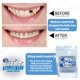 thumbnail image 4 of Carilla dental instantánea Secure Fit para dientes superiores, tono natural, 4 of 8