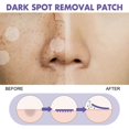 thumbnail image 4 of Spot-reducing patches lighten dark spots, age spots, and freckles on the face, moisturize and whiten skin., 4 of 4