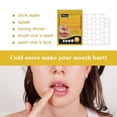 thumbnail image 5 of Clearance Parche para ampollas bucales,parche para ampollas en los labios causadas por herpes labial,parche hidrocoloide para el cuidado de los labios que cura el herpes labia, 5 of 5