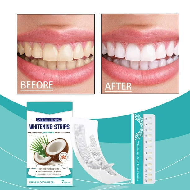 Parches para limpieza profunda y eliminación del amarilleamiento dental para mejorar el brillo de los dientes. Productos para el cuidado dental en casa. 7 parches dentales.