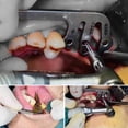 thumbnail image 2 of Dental Implant Guide Set,6pcs/Set Implant Guide Set Dental Implant Guide Locator,Dental Implant Locating Guide Plate for Dentist Orthodontic Tools, 2 of 5