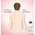 thumbnail image 2 of Caladryl Skin Soothing Solution | Skin Allergy Expert Lotion 65 ml Lotion, 2 of 2