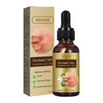 thumbnail image 4 of Coconut oil Essential oils Skin Moss Oil Skin Itching, Stop Itching, Swelling, Hand And Foot Moss External Care Oil（30ml） Essential(buy 2 get 10% off), 4 of 5