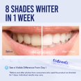 thumbnail image 2 of Kit de blanqueamiento dental VieBeauti con dientes sensibles a la luz LED, 2 of 8
