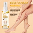 thumbnail image 4 of Varicose Veins Spray, Varicose Veins For Removing Varicose Veins, Spider Veins Removal Spray, Spider Veins Spray, Varicose Veins Spray To Leg Pain 30ml, 4 of 5