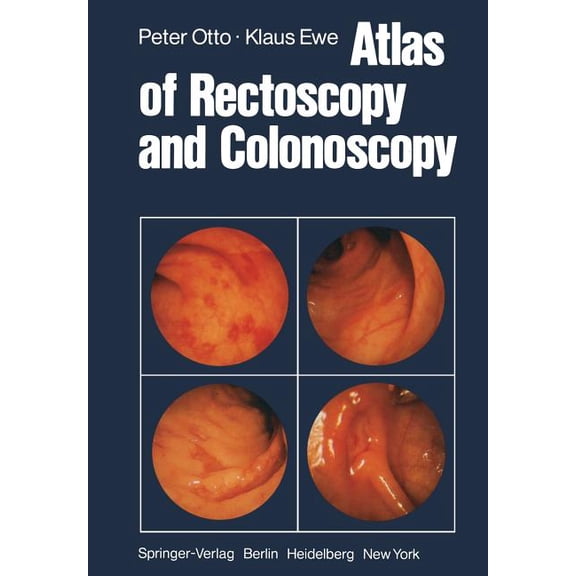 Atlas of Rectoscopy and Coloscopy, (Paperback)