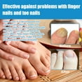 thumbnail image 6 of Nourishing Foot Spray Prevents Athlete's Foot Treats Skin and Nails, 6 of 9