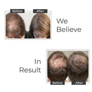 Moehair Hair Guard Shampoo | Hair Loss Shampoo 12 fl oz | All Hair Types