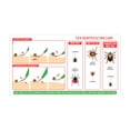 thumbnail image 2 of Kit removedor de garrapatas SIVOTE de acero inoxidable con estuche de cuero, 2 of 6