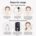 thumbnail image 3 of keepw Blackhead Vacuum Remover USB Rechargeable Electric Pore Suction Woman Home Tool Woman Home Face Skin Care Deep Cleaning Extractor, 3 of 8