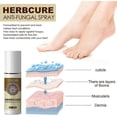 thumbnail image 4 of Treatment Fungus Infections Combat Anti Itching Anti-Fungal Feet Spray 60ML_c*, 4 of 5