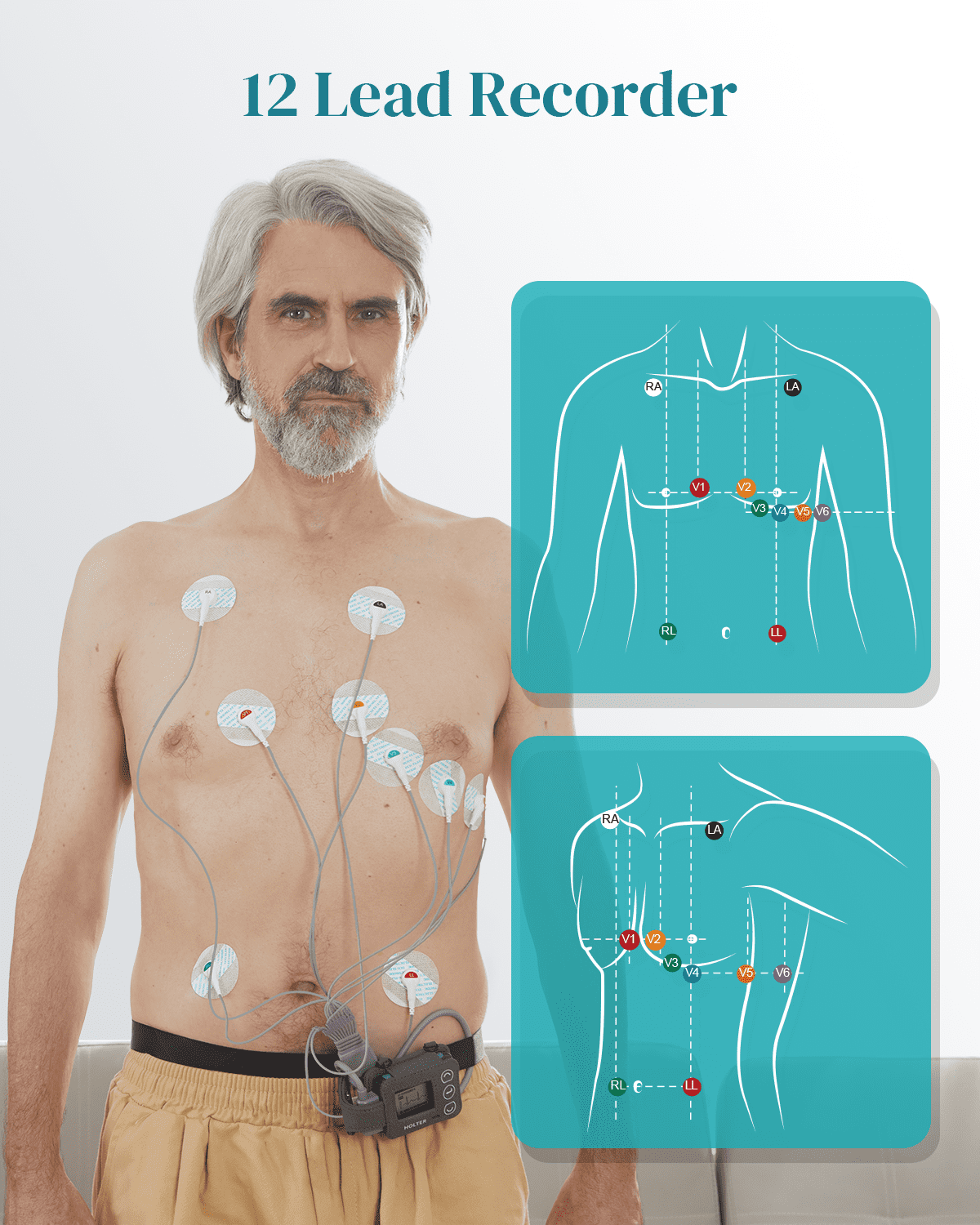 Holter Monitor Most Accurate Heart Rate Chest Strap AI-Generated