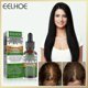 thumbnail image 1 of Rosemary Hair Growth Essential Oil Anti Hair Loss Fast Regrowth Essence Repair Damaged Frizzy Thinning, 1 of 5